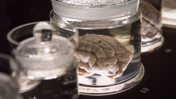 Das Gehirn - Intelligenz, Bewusstsein, Gefühl Das Gehirn – Intelligenz, Bewusstsein, Gefühl